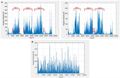 Feasibility of Using Commercially Available Accelerometers to Monitor Upper Extremity Home Practice With Persons Post-stroke: A Secondary Data Analysis